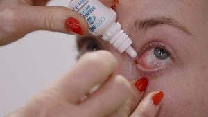 Home remedies and eyes irritation