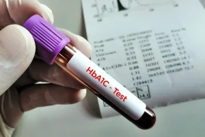Complications for type 2 diabetes