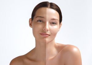Skin cancer remedies