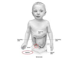 Abdominal pain and children