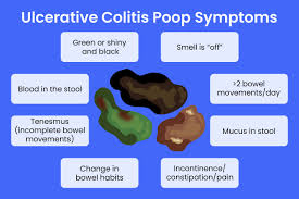 Signs of ulcer