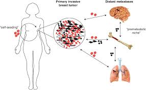 Breast cancer and it's effects