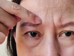 Sleep loss tips