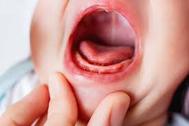 Signs of teething