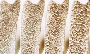 Carbonated drinks side effects