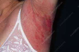 Reasons for wearing deodorants