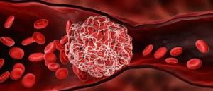 Benefits of HRT
