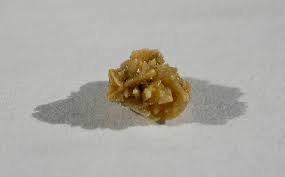 Analysing kidney stones