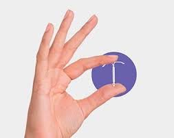 IUD and contraception