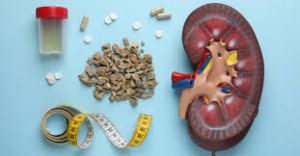 Analysing kidney stones
