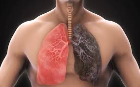 General health and smoking