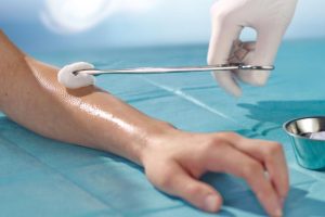 Infection Prevention and Antiseptics