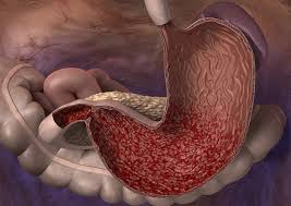 Causes of pains in the stomach