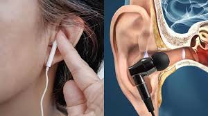 Earphones and side effects