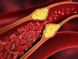 Cholesterol and natural herbs