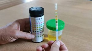 Pregnancy and Urine test 