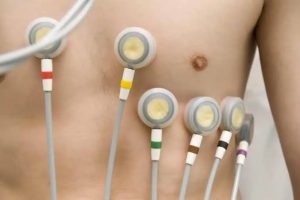 Side Effects of ECG