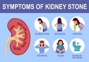 Risk Factors of Kidney Stones