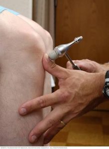 Treatment Tips for Multiple Sclerosis