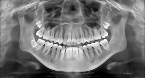 Uses of X-rays