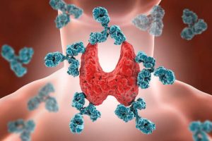 Common Thyroid Issues