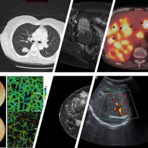 Uses of X-rays
