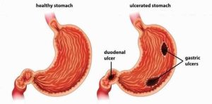 The Health Advantages of Cloves