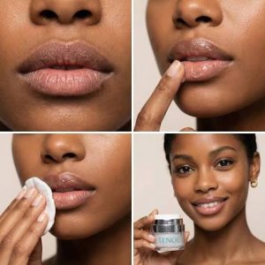Chapped Lips Prevention Tips