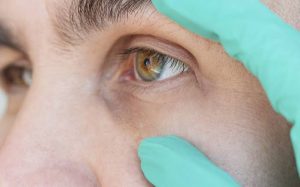 Dilation of the Pupil