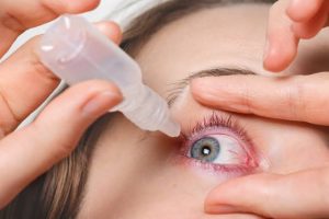 Watery Eyes Diagnosis