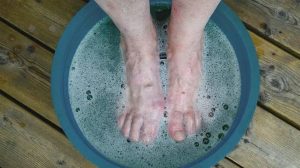 Calluses Diagnosis